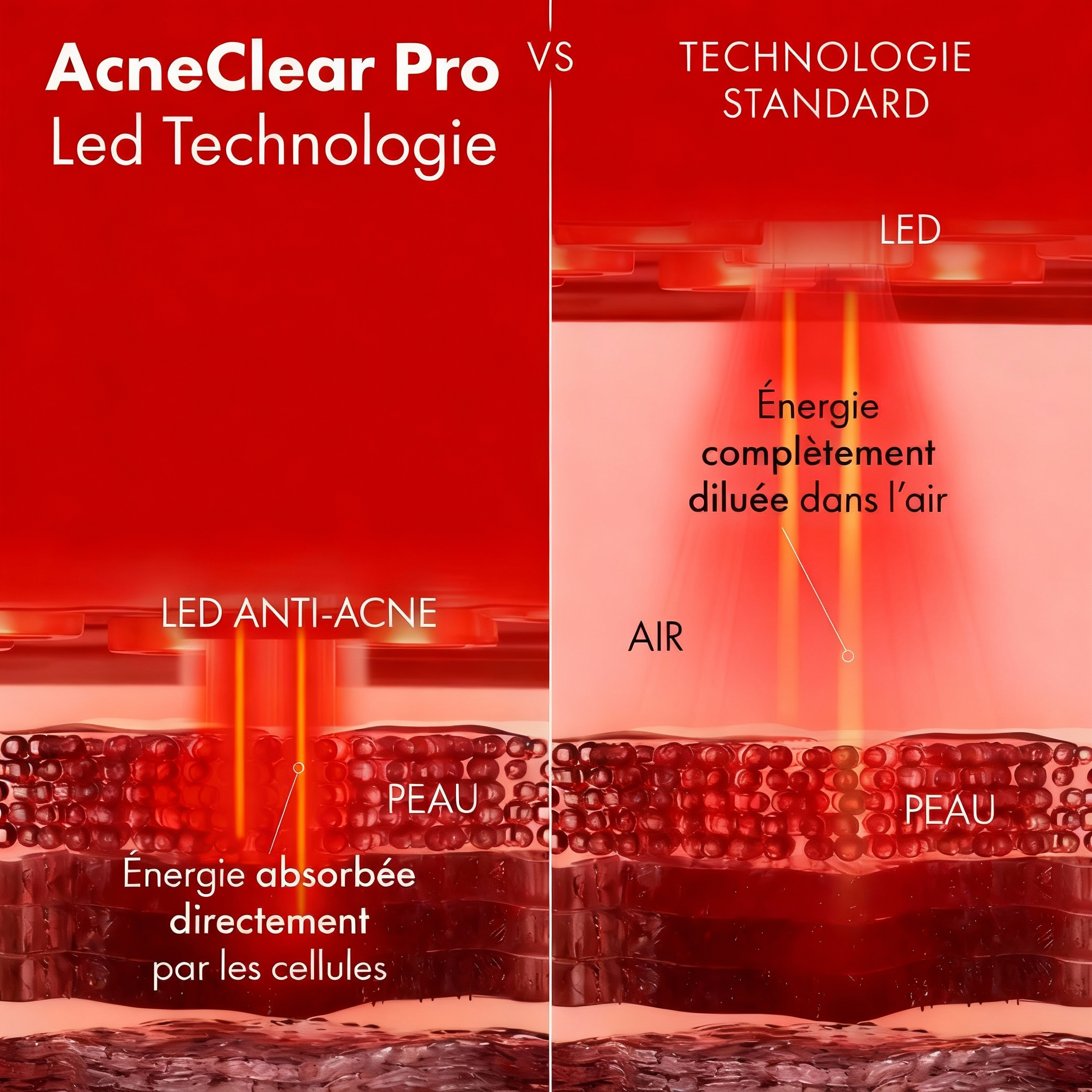 AcneClear Pro - Masque Anti-Acné
