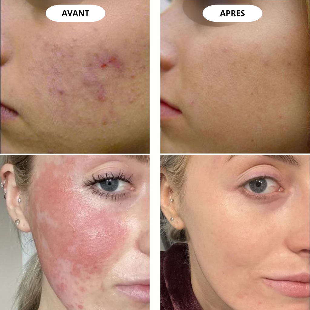 Masque LED Visage Premium