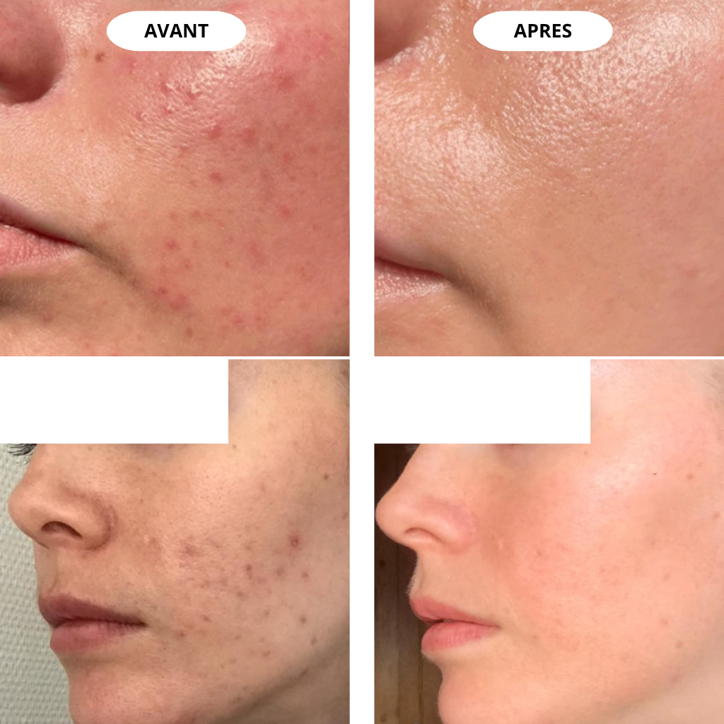 Masque LED Visage Premium